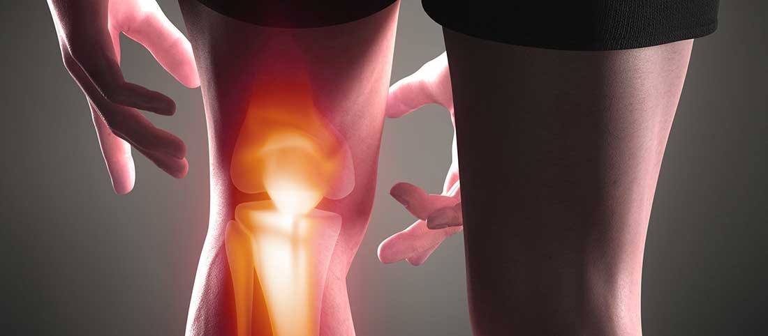 ACLanterior cruciate ligament Injury ACL(anterior cruciate ligament) Injury