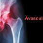 Avascular Necrosis Avascular Necrosis(AVN)