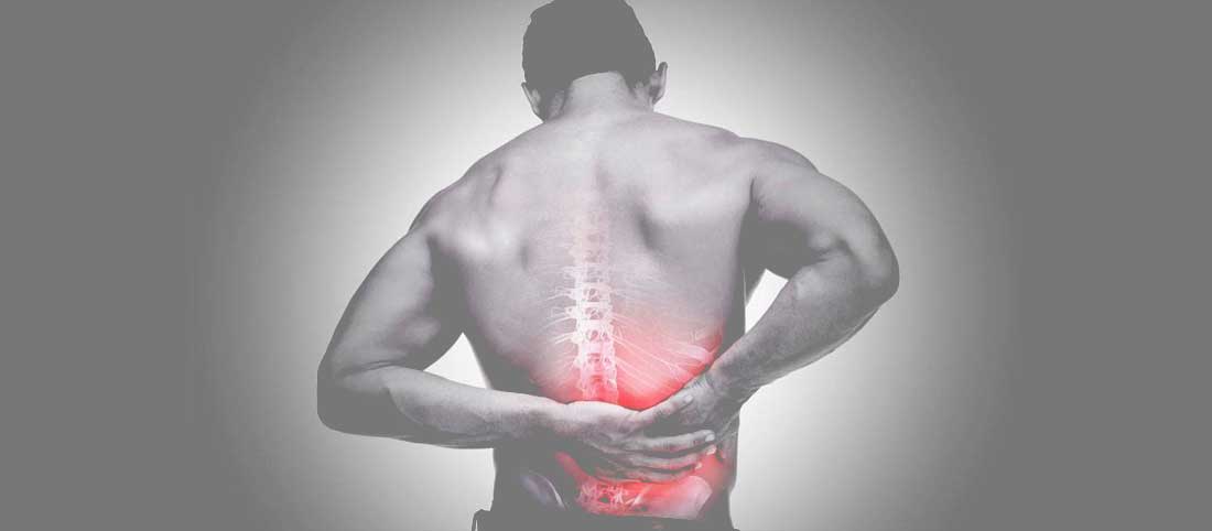 Cauda Equina Syndrome Cauda Equina Syndrome