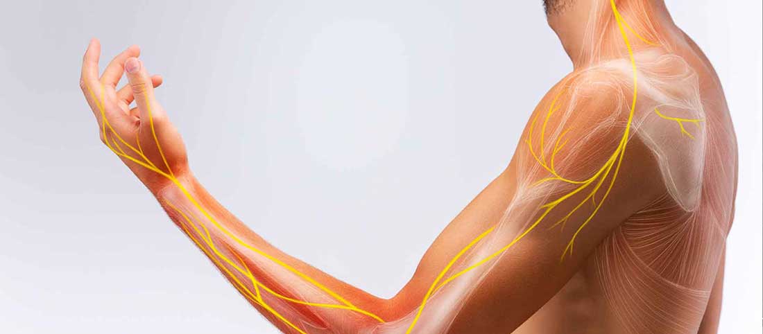 Thoracic Outlet Syndrome Thoracic Outlet Syndrome