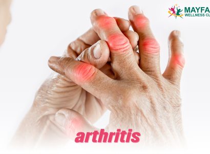 Rheumatoid Arthritis Joint Pain Mayfair Best Physiotherapy Center in Dhaka
