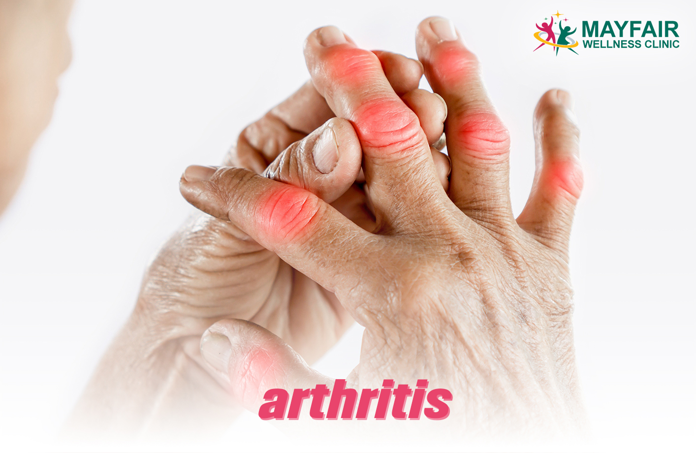Rheumatoid Arthritis Joint Pain Mayfair Arthritis